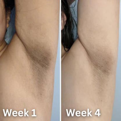Pureul® Skin Brightening Deodorant